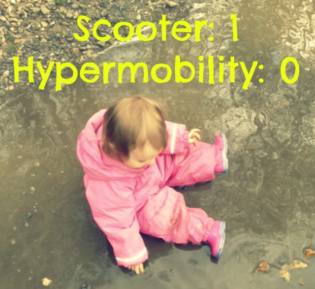Hypermobility toddler
