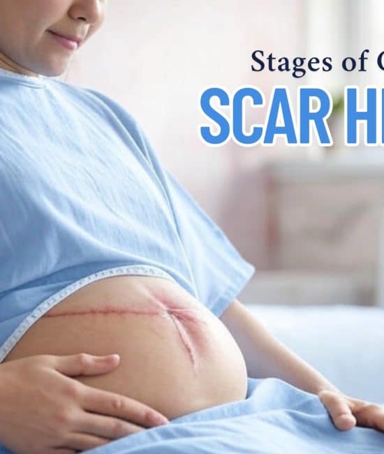 From Pain to Recovery: C-Section Scar Healing Stages