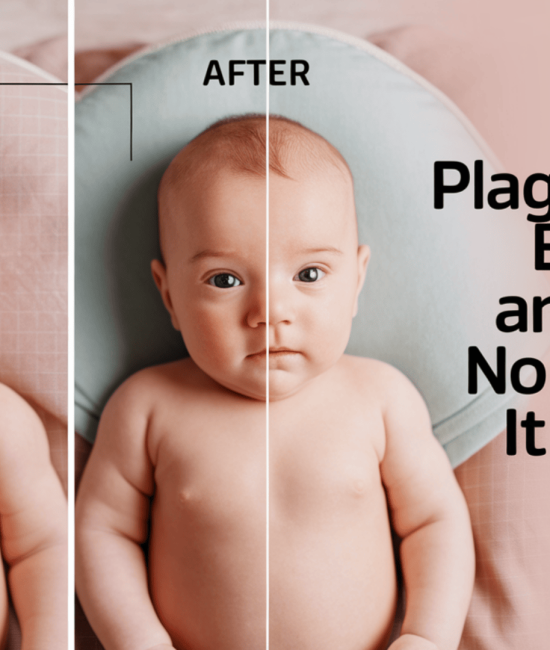 plagiocephaly before and after no helmet
