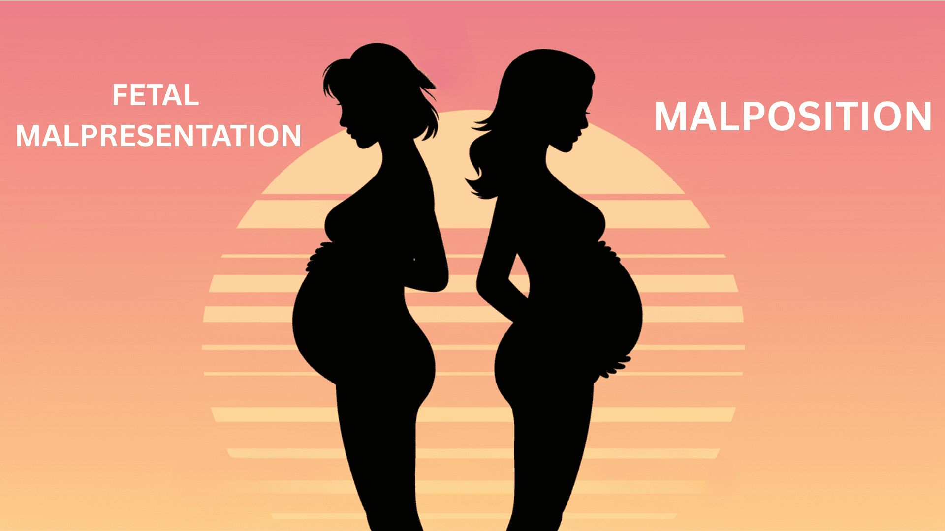Malpresentation_vs_Malposition_Understanding_Baby_Position_Problems