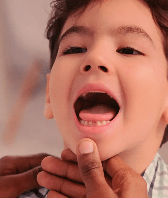 How Can Moms Manage Wisdom Tooth Pain While Caring for Kids?
