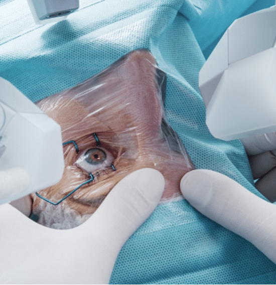 NYC LASIK Surgery – Trusted, Precise, Proven: Choosing the Right Pros