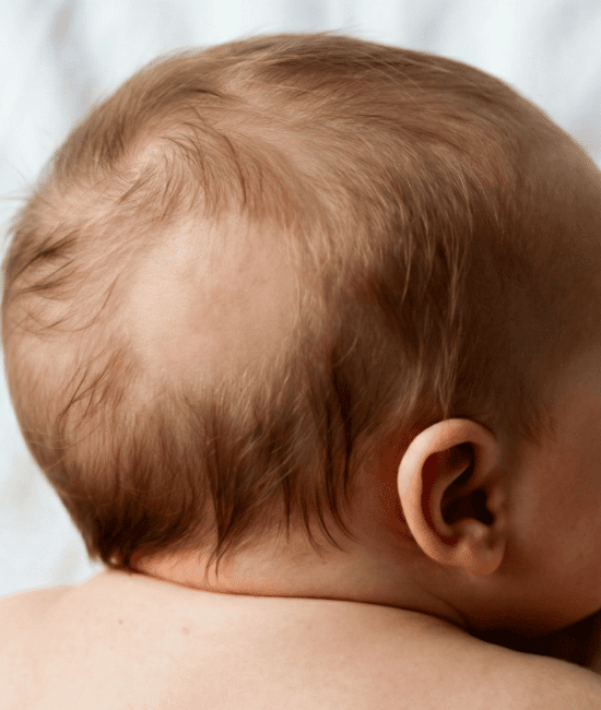 when do babies lose their hair (2)