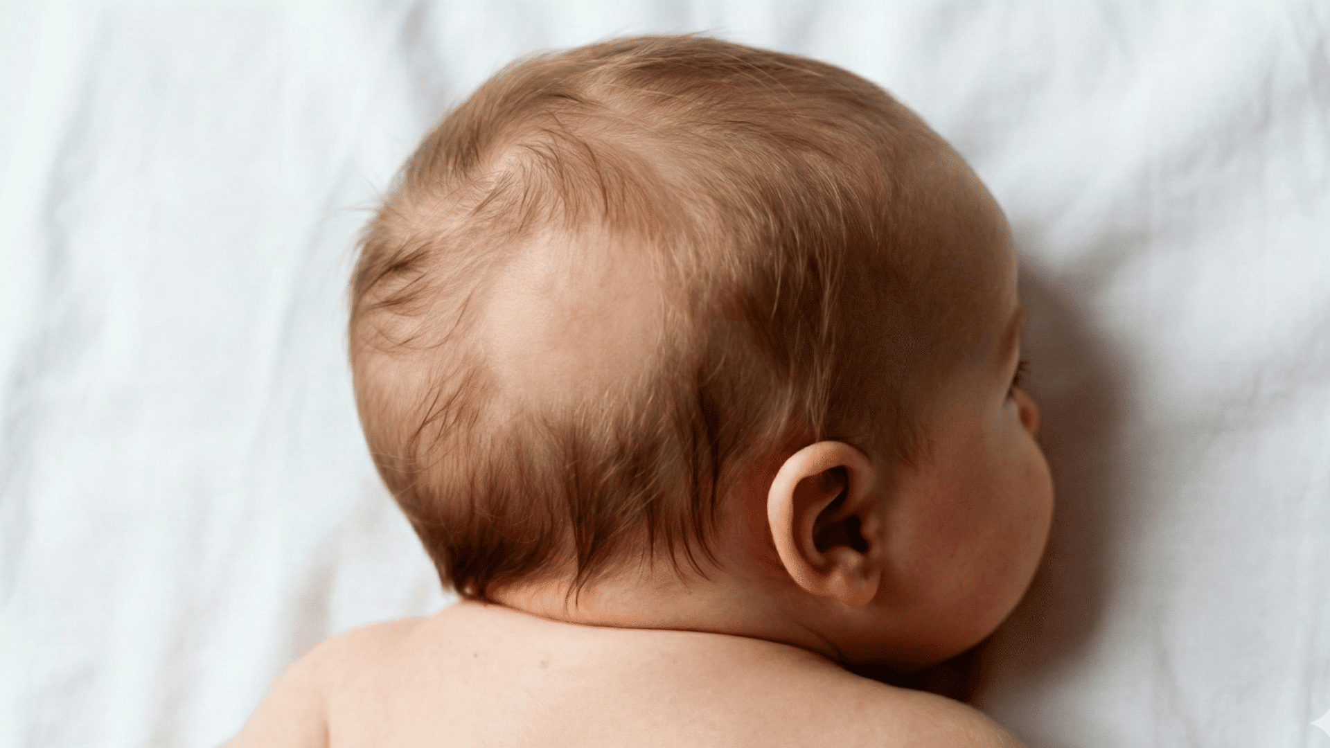 when do babies lose their hair (2)