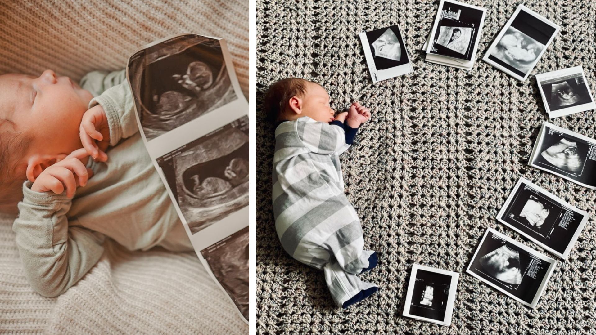 baby with ultrasound photo