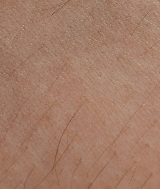 What Microneedling Really Does for Your Skin