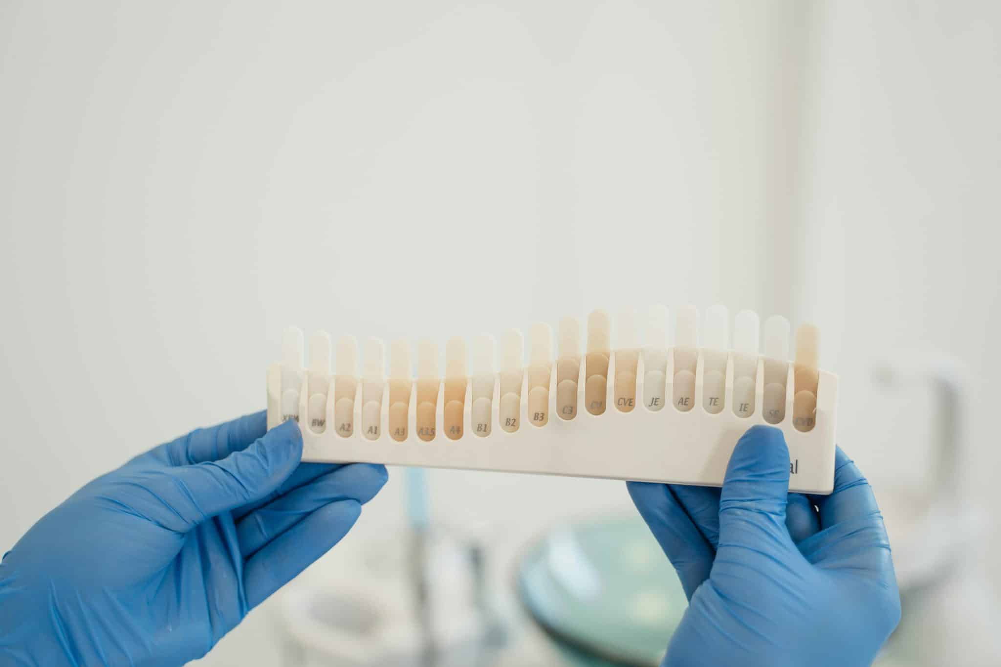 Do Veneers Stain?